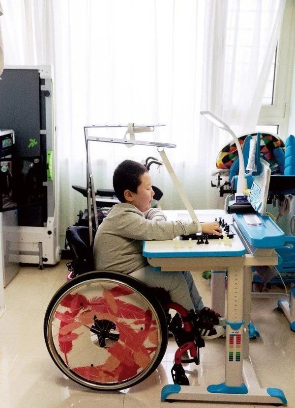 脊髓性肌萎缩症又被称为进行性脊髓性肌萎缩症,脊肌萎缩症,是一类由