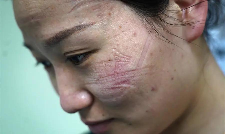 医生只能做决定让哪个病人先死看着失控的意大利疫情才知道中国民众的