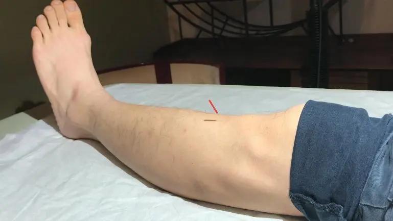 膝眼穴 来自搜狐网