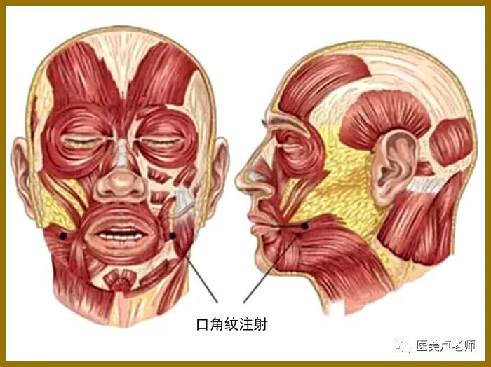 肉毒素降口角肌图片