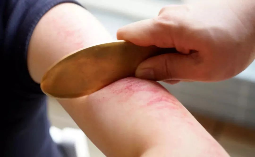 刮痧油 铜板,刮出了美容仪的提拉紧致效果