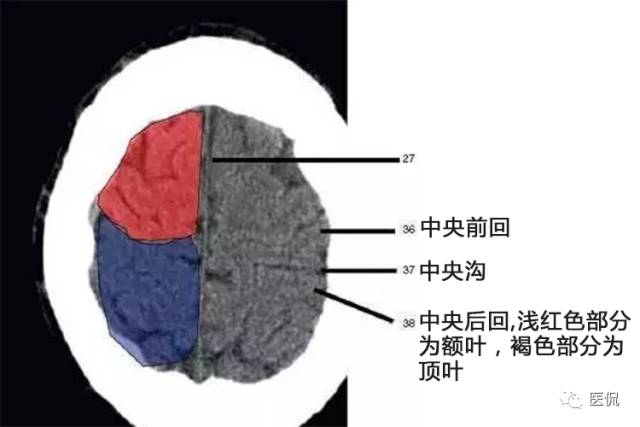 顱腦ct彩色解剖圖更有意想不到的學習秘訣