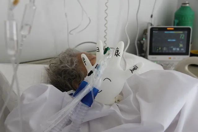 市红十字会医院呼吸内科一病区,一名护士将手套吹成气球,撑着氧气管