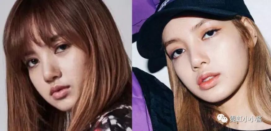 我们在争论lisa整没整容的时候人家已经是最大赢家了日本医美