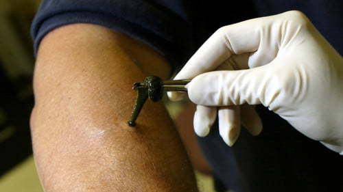 如果不小心生吞了蚂蟥,它真的会在肚子里存活吗?_水蛭