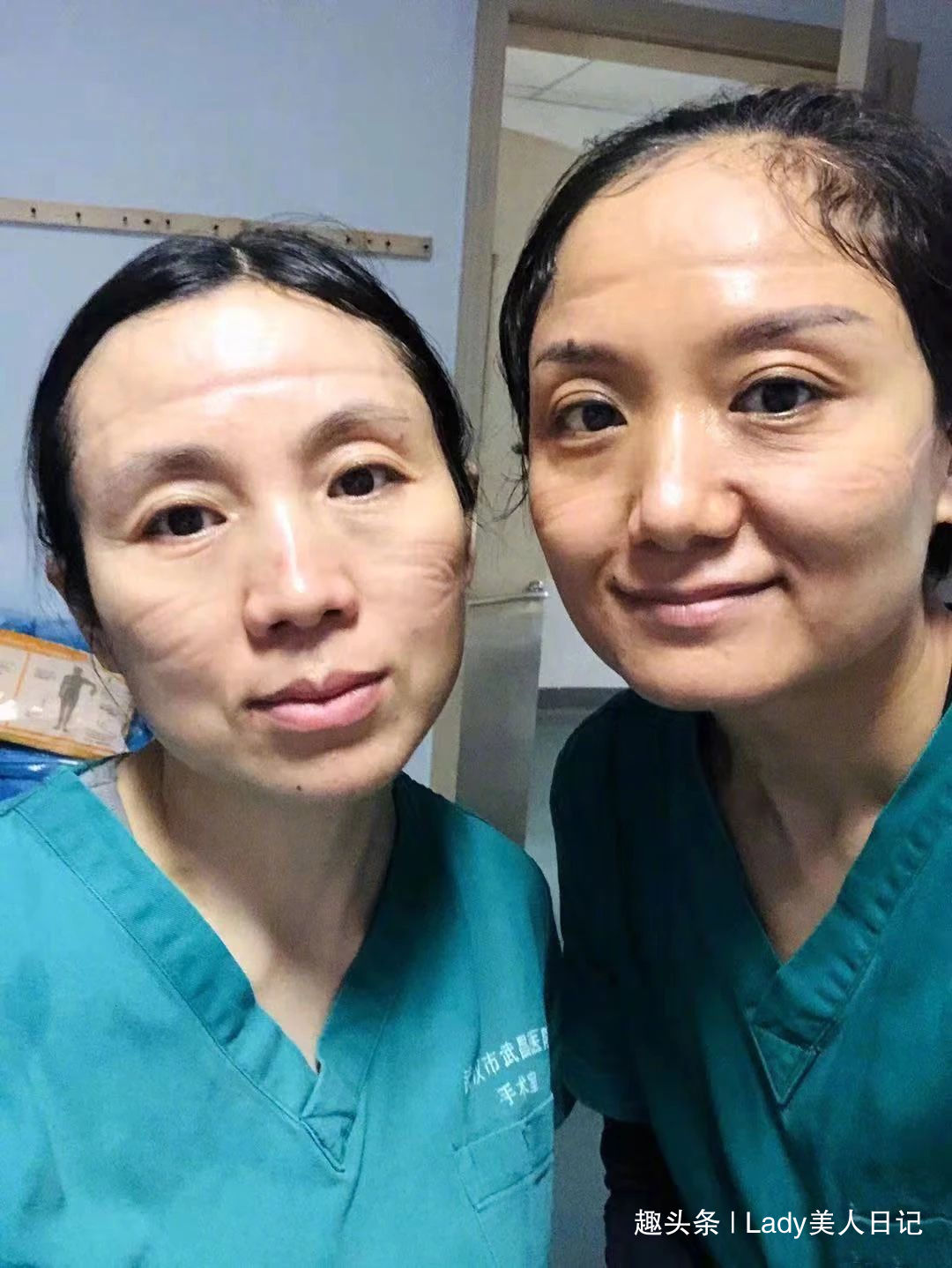 当她们摘下口罩那一刻肯定很多人心疼但是没人会嫌她丑