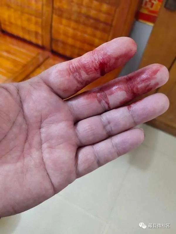 藤县李某拿起菜刀对抗警察还划伤