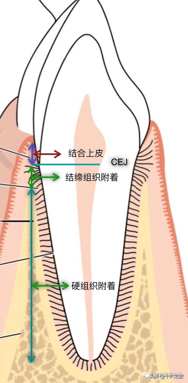 从生物学宽度到牙周愈合机制