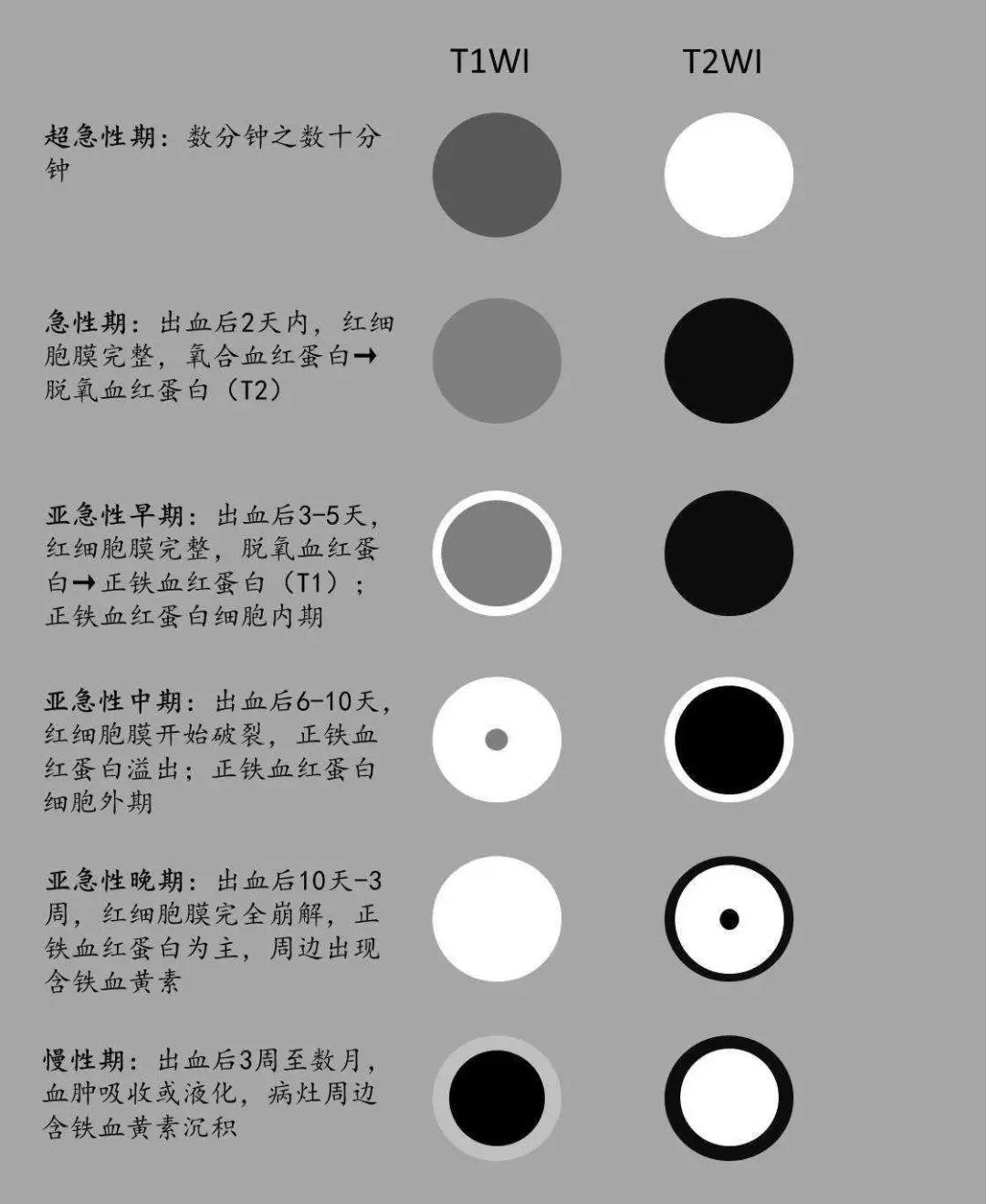 影像| 一图一表巧记脑出血mri信号演变