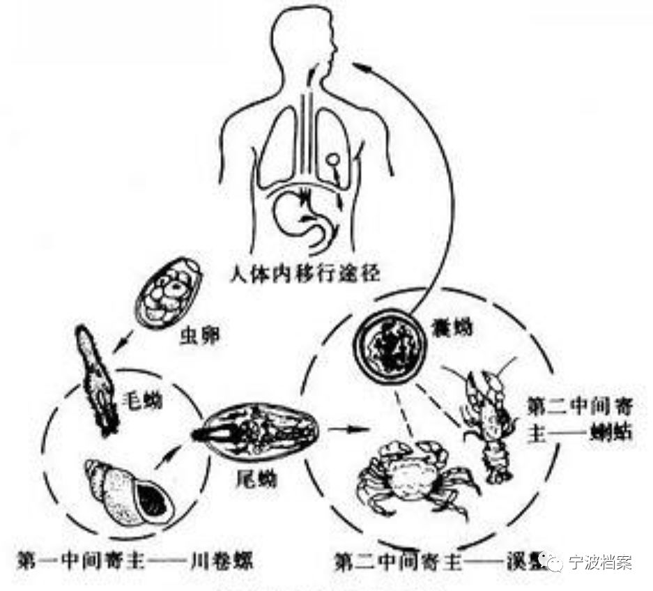 并殖吸虫生活史吃生蟹等易感染肺吸虫病5地方性甲状腺肿是以缺碘,致