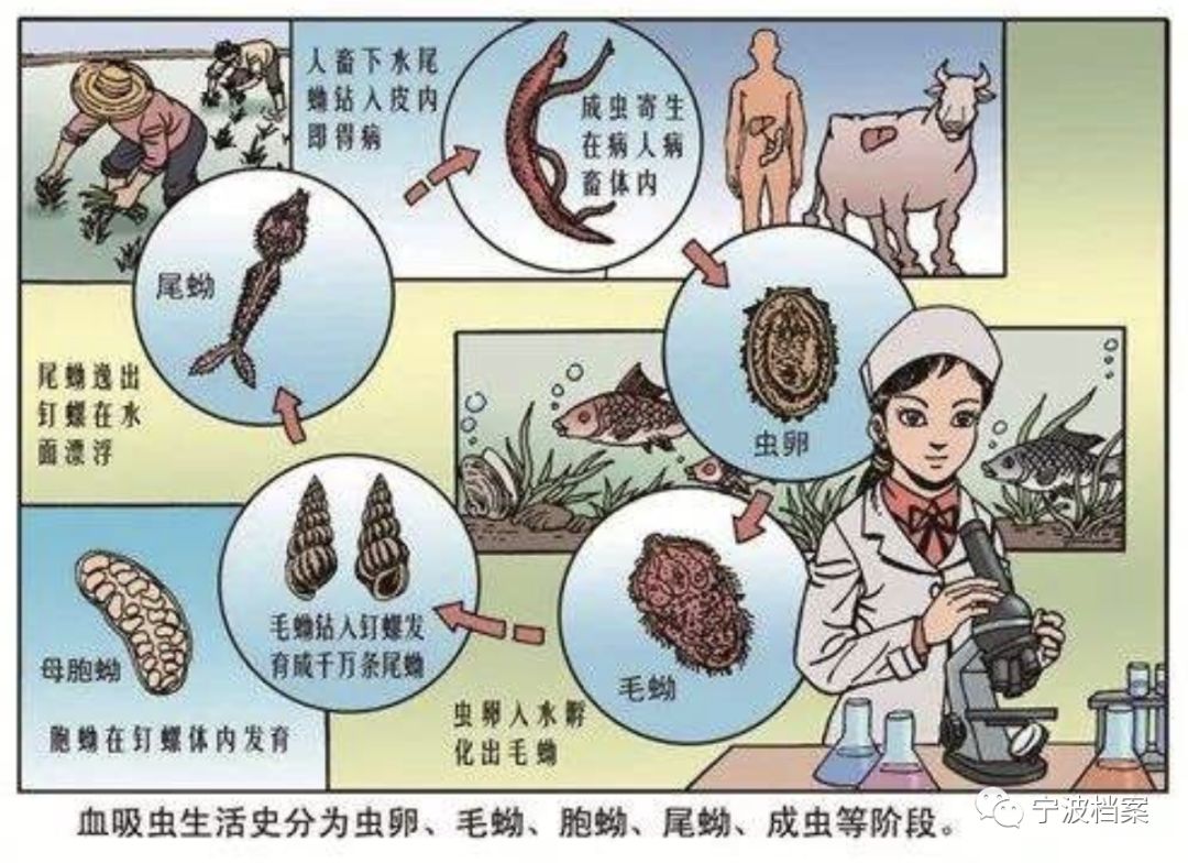 常致大肚子2丝虫病丝虫寄生于人体引起的慢性寄生虫病