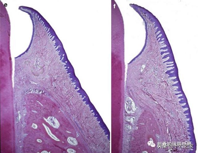 上面的图片和英文文字都说明了一个观点:口腔上皮和