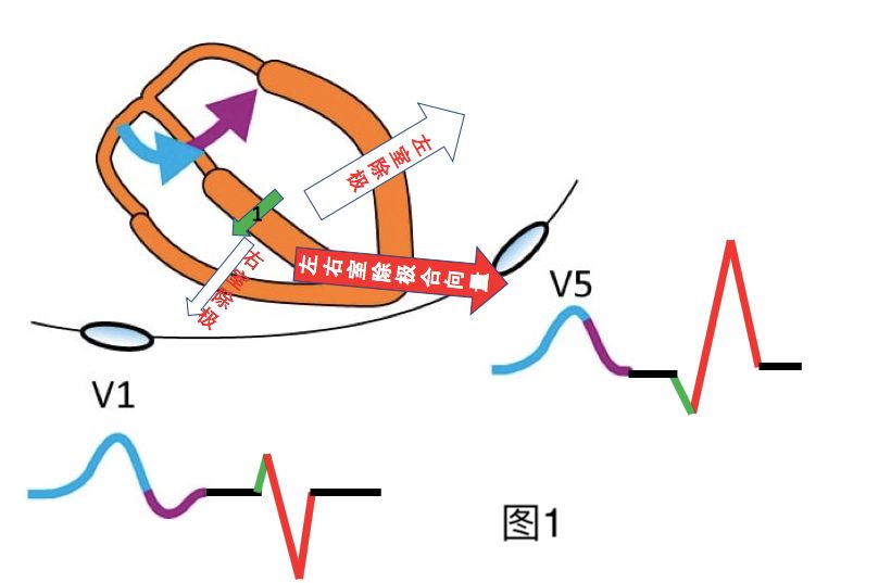 心室除极方向示意图图片