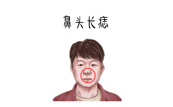 万两难买5颗痣