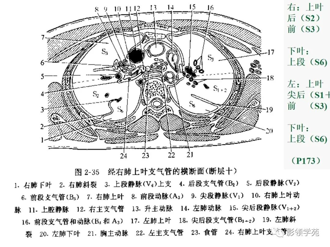 v4的段间支分上舌段与下舌段左肺上叶v6的段间支用以区分上段与各底段
