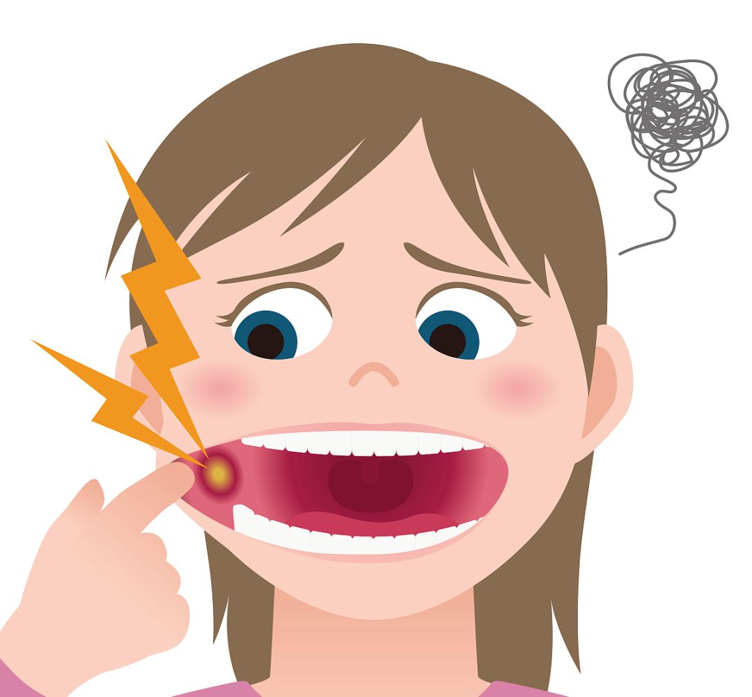 名医专栏丨口腔溃疡反复发作怎么办