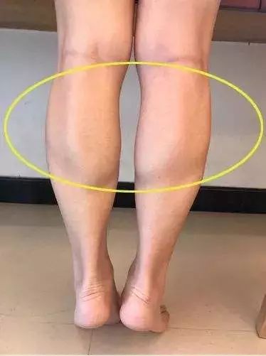 宋茜,周冬雨都太狠了,小粗腿变身漫画腿,原来只做了这些?_小腿