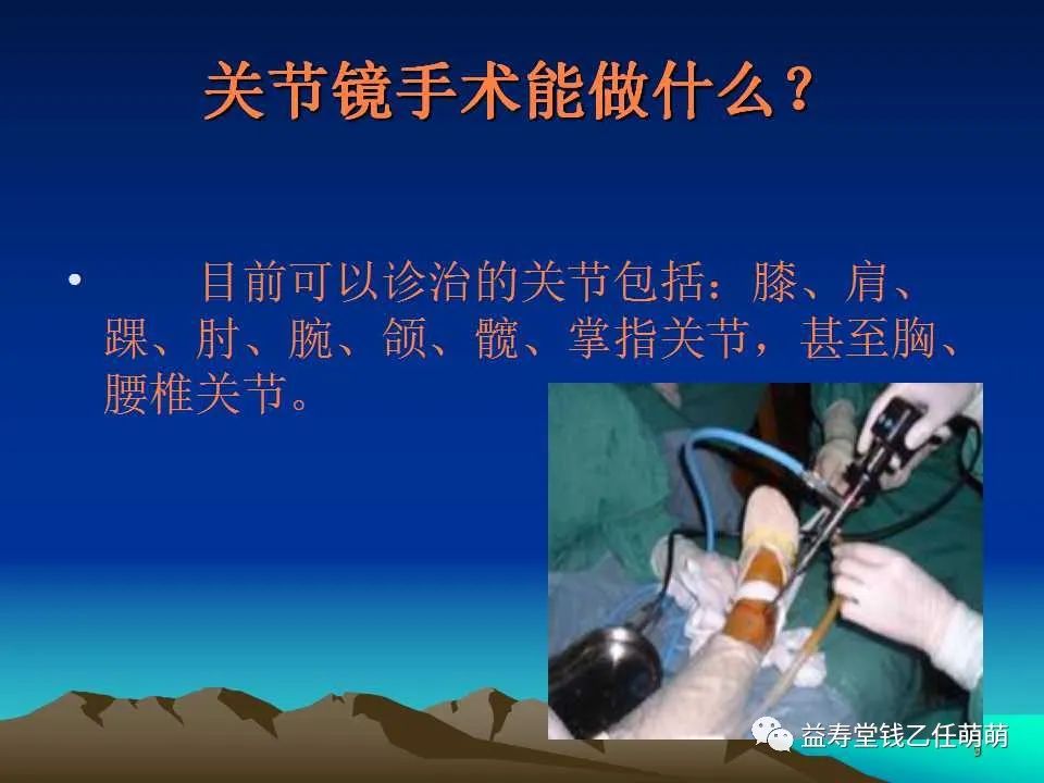 关节镜的应用_闭孔器