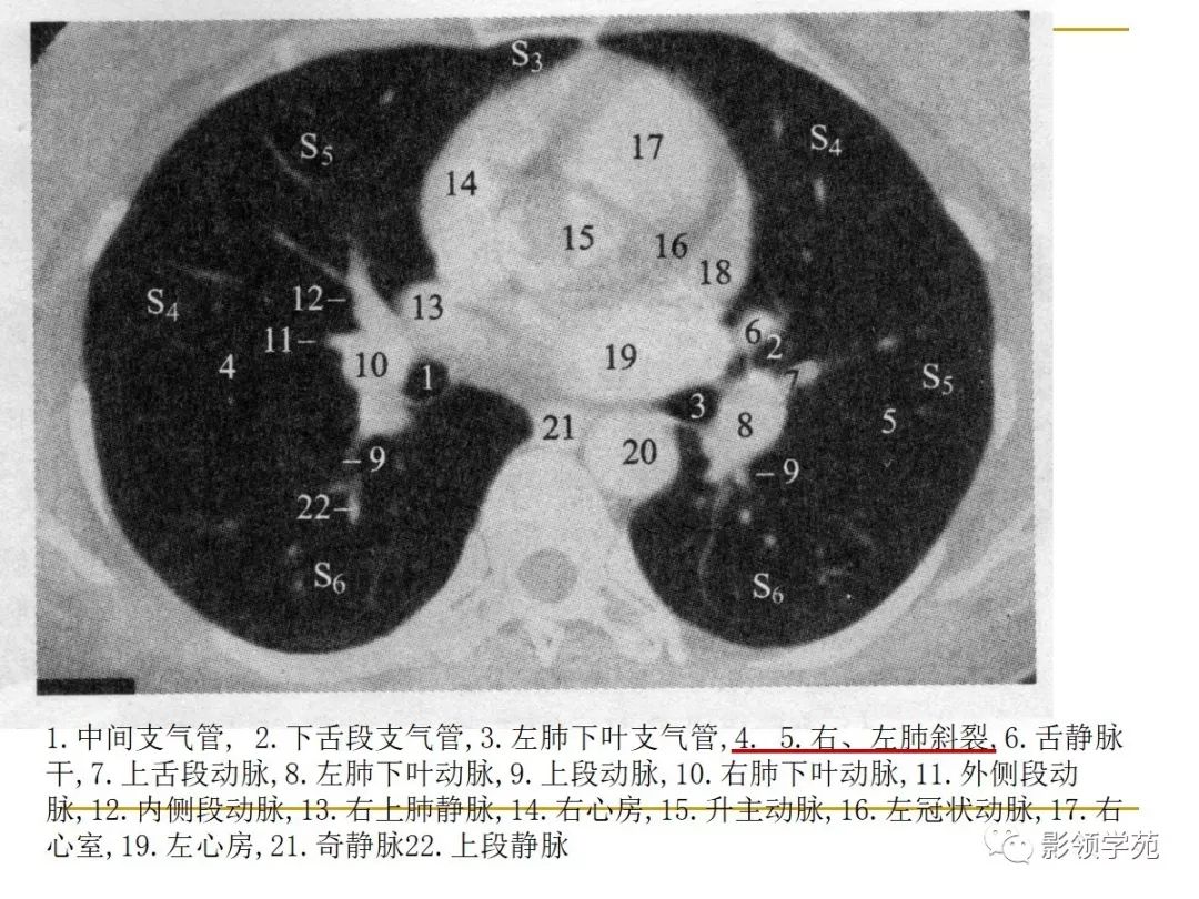 肺段與肺內管道應用解剖_支氣管