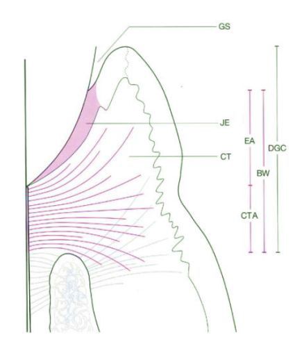生物学宽度(biological width,bw)指的是牙槽骨嵴顶至龈沟底的距离