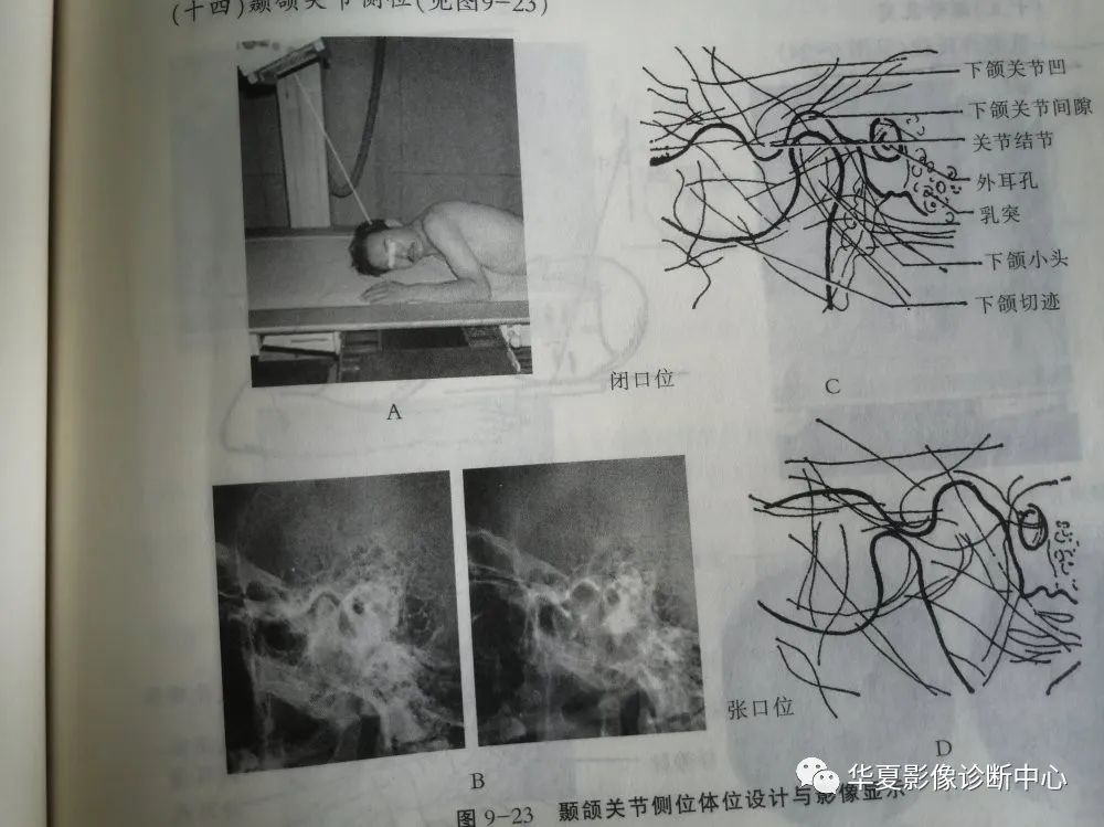 头颅前后半轴位图片图片