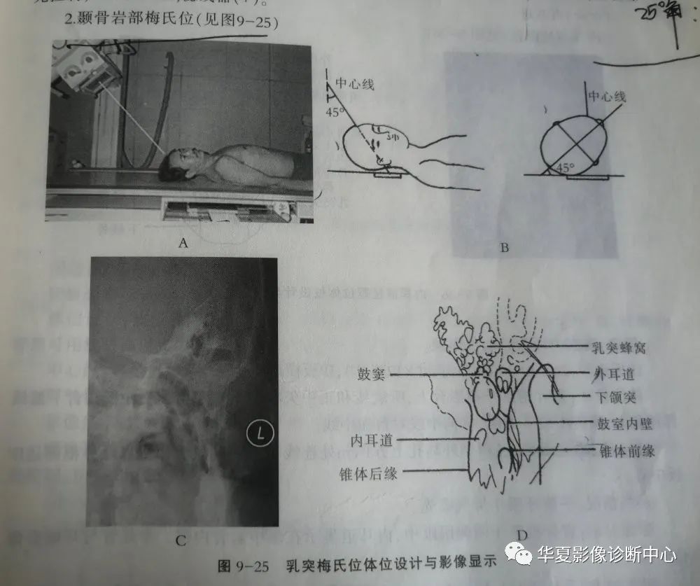 这是一篇80年代的影像技师才能看懂的检查单诊断师勿点头颅特殊部位