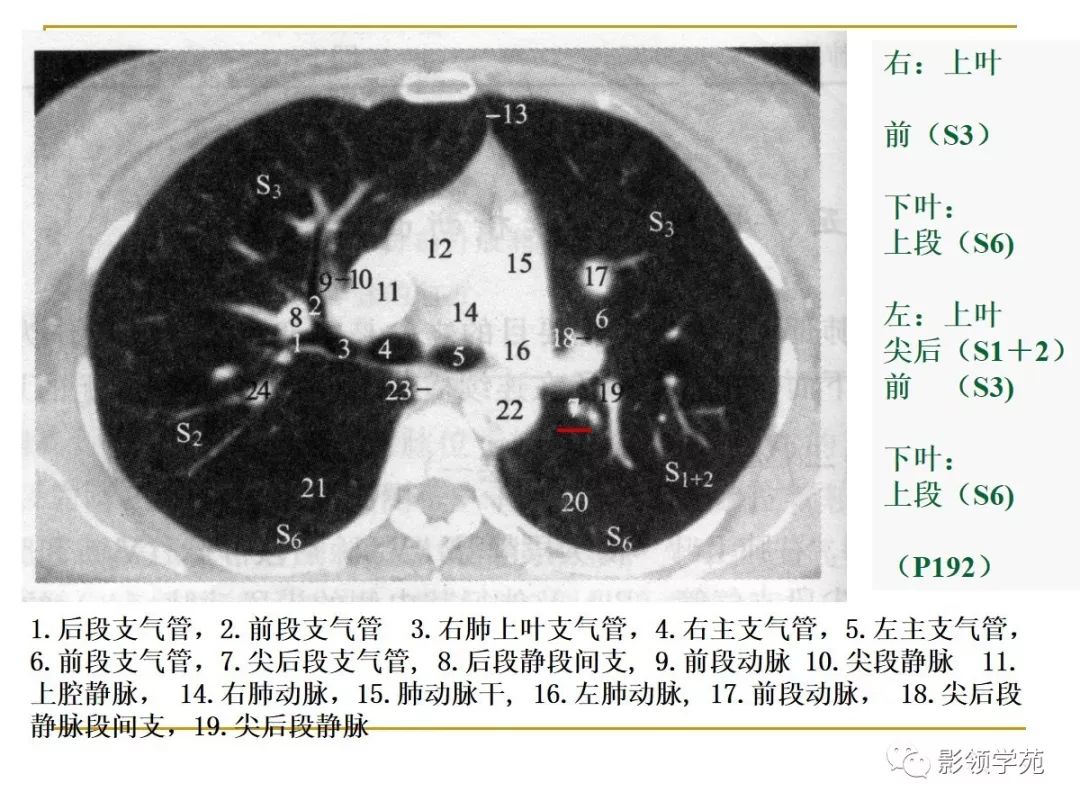 肺段與肺內管道應用解剖_支氣管