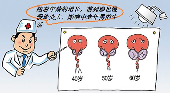男性健康 | 前列腺增生患者,疫情期间在家如何自我管理?_症状