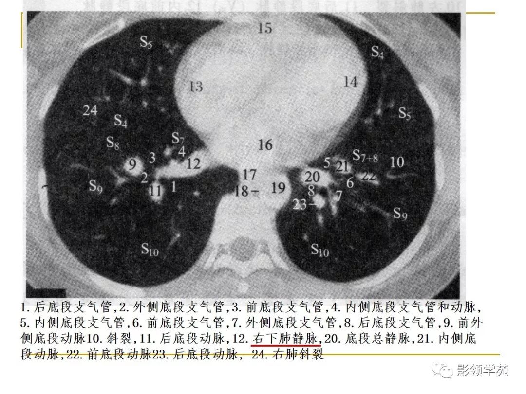 肺段與肺內管道應用解剖_支氣管