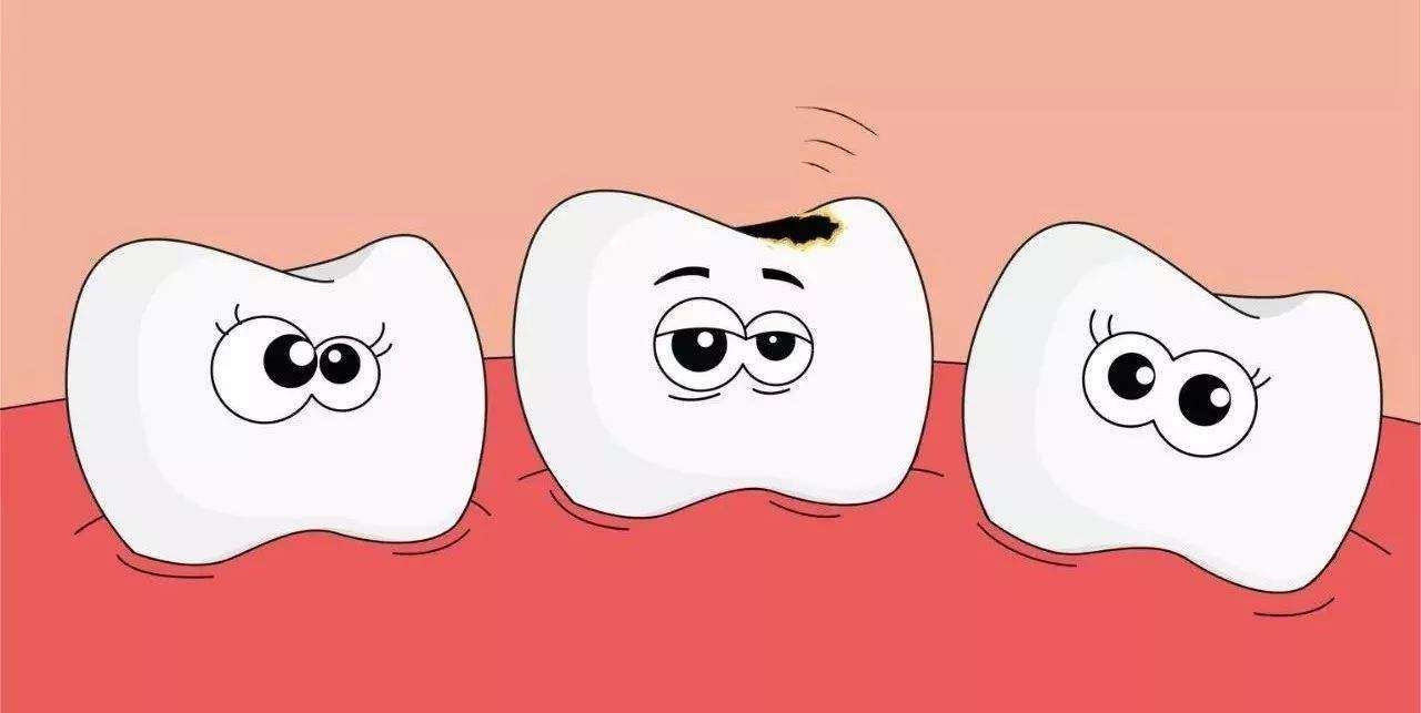 齲齒不補不疼補牙後反而疼是咋回事