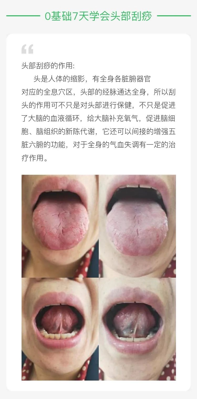 张秀勤:怎样通过面部来看五脏的健康?_刮痧