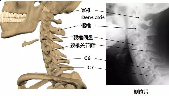 颈椎解剖图及结构图片