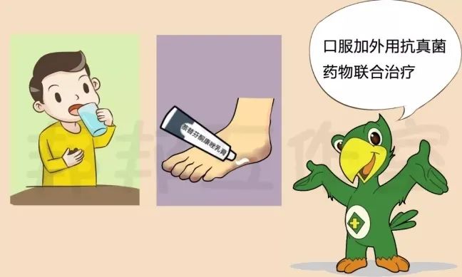 一般足癣首选外用药,包括唑类,丙烯胺类,吗啉类,环吡酮类和硫脲类等外