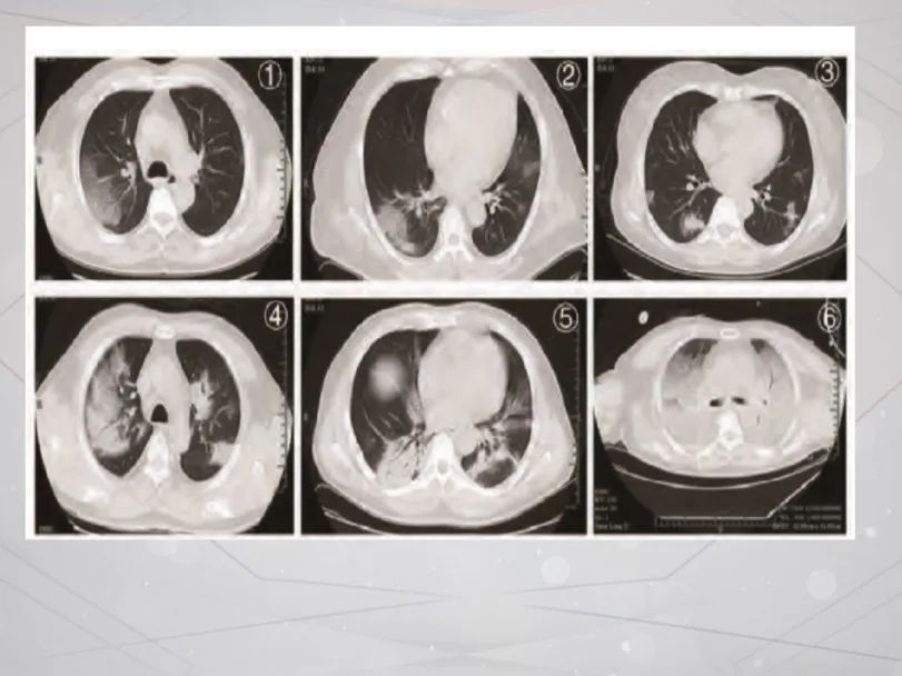 最近,因为新冠肺炎疫情,大家对于肺部健康尤其关注.