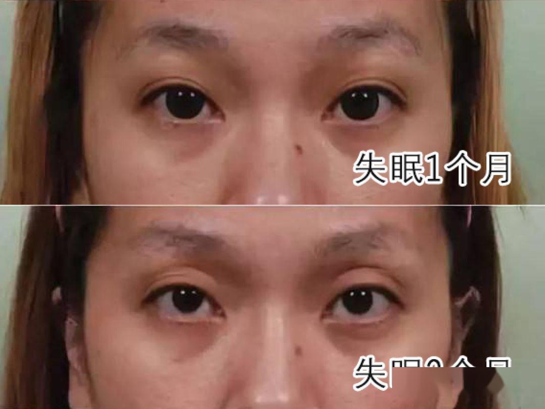 宁心静心祛湿排毒调和脾胃湿重人群坚持20天拥有好睡眠