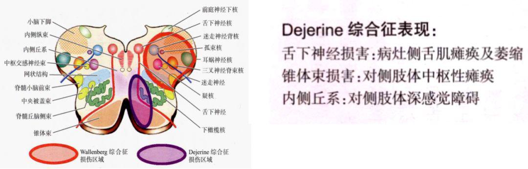 神经纤维纵断面图片