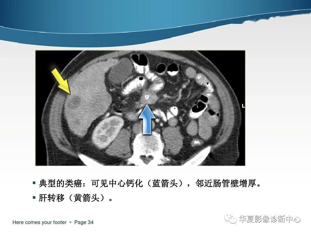 过目不忘的腹膜及肠系膜病变