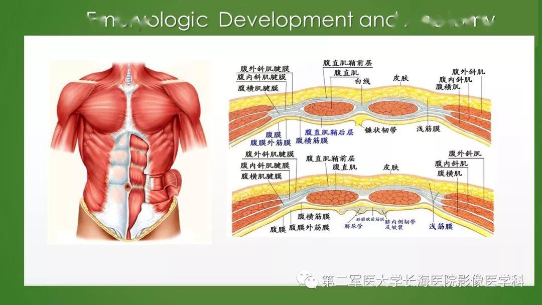 脐尿管异常的影像表现与临床