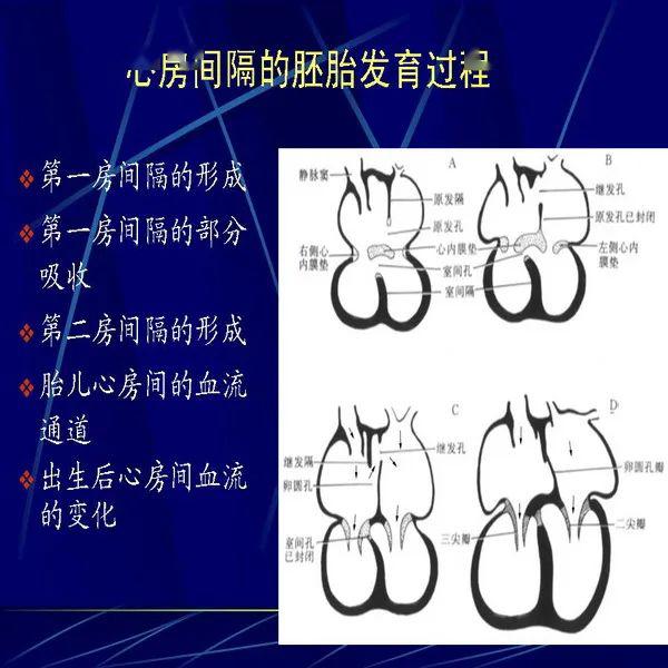 房间隔发育过程图片图片