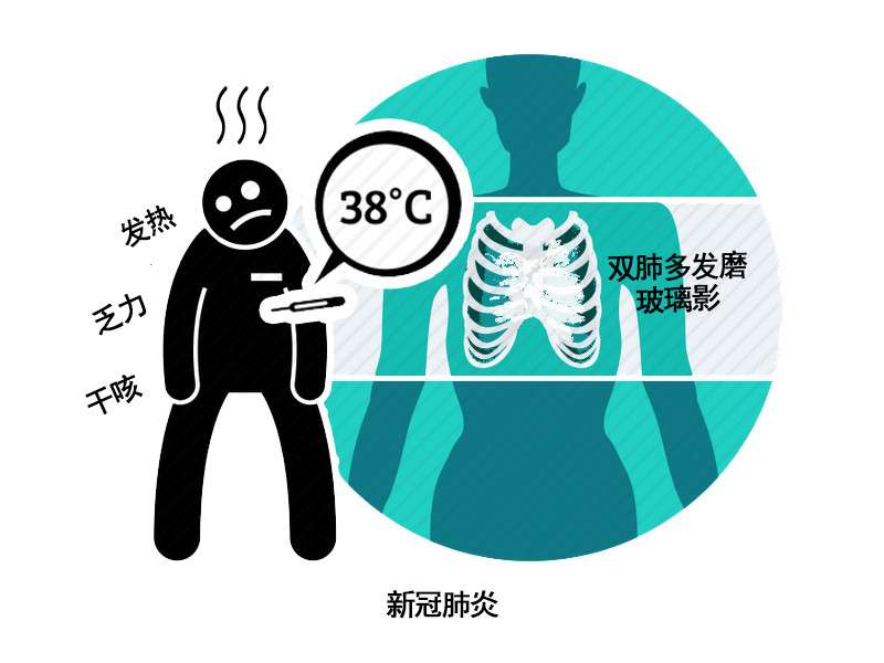 原創乾貨病毒性肺炎與細菌性肺炎有哪些區別疫情當下你應懂區分