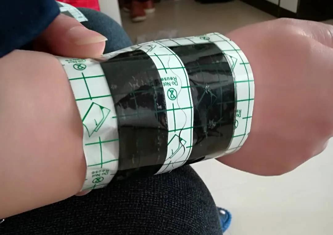 小心可能得了"妈妈手"!