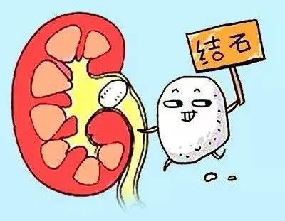小石头大麻烦,难道只能一碎了之?中医专家李琦告诉你肾结石得这样治