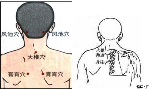 孩子突然鼻腔出血其实除了上火还有一个这样的原因经常被忽视