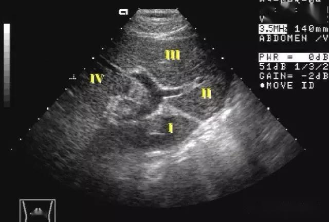 肝脏的8个分段超声图图片
