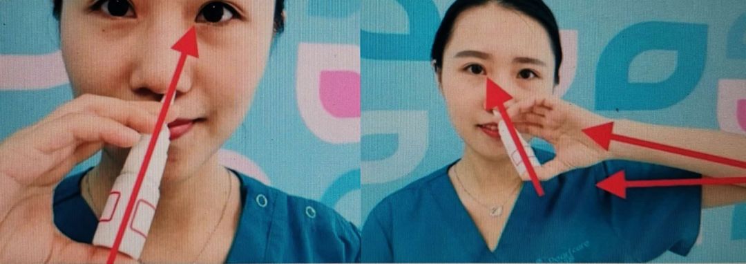 哈尔滨·3月27日花粉实况播报