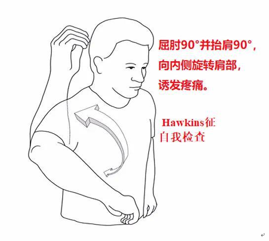 hawkins撞击试验图片