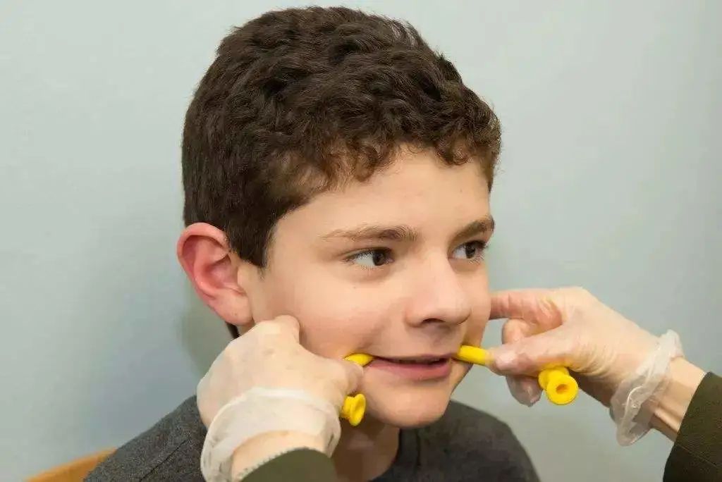 关于儿童口肌的五大问题来了解下吧