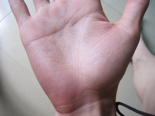 手掌就能看出你身体是否健康