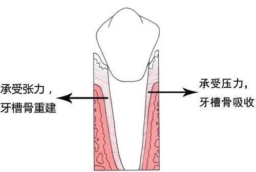 ▼ 牙齿移动原理(牙槽骨改建)要想精准地达到以上条件,并且还能根据