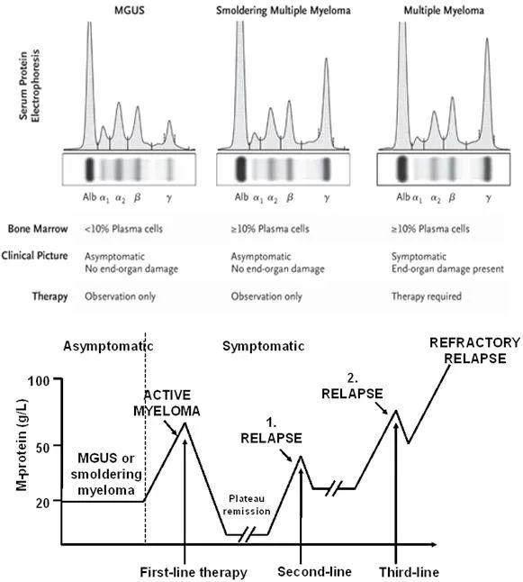 多发性骨髓瘤(mm)的常用检查和意义